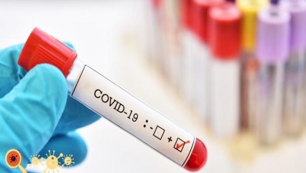 Acre registra 110 novos casos de covid-19 nesta segunda-feira e confirma mais 4 mortes 